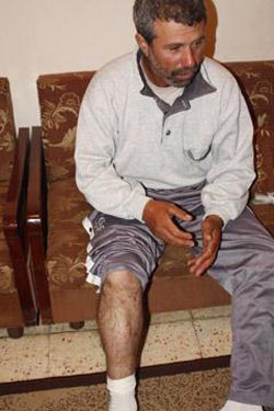 Moqawama.org’s Exclusive on Cluster Bombs: Buried Alive