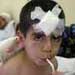 Seven year-old Lebanese wounded by an 
