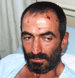 Al Intiqad Report: “Israeli” Enemy Releases Abducted Shepherd, Leaves Terrorism Scars All over His Body 