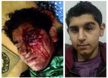Bahrain Sentences Injured Youth to 6 Months Jail