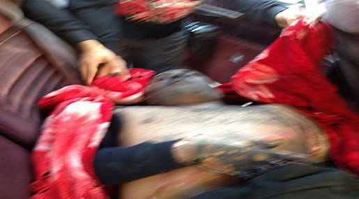 Saudi Police Raids Al-Awamyieh, Martyrs Civilian