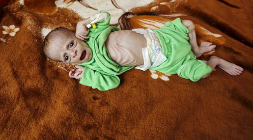 Yemeni Child