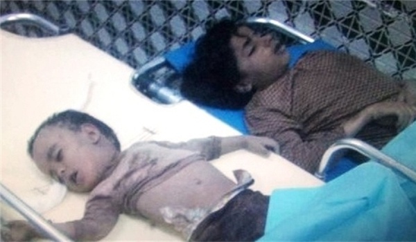 Yemeni Crisis