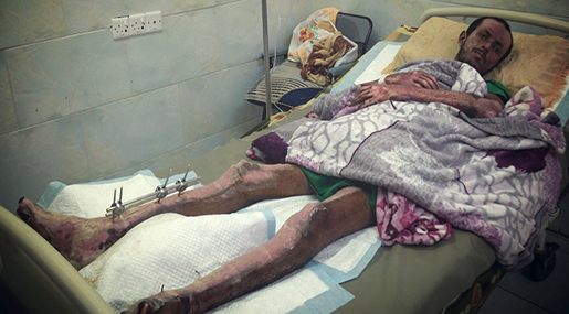 RevSHUKRI_ALI_SAEED  Shukri Ali Saeed lies in the hospital two months after an airstrike hit the truck he was driving in Lahj, Yemen, on June 18, killing two passengers.