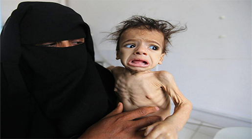 Yemen: A Nation on the Brink of Famine