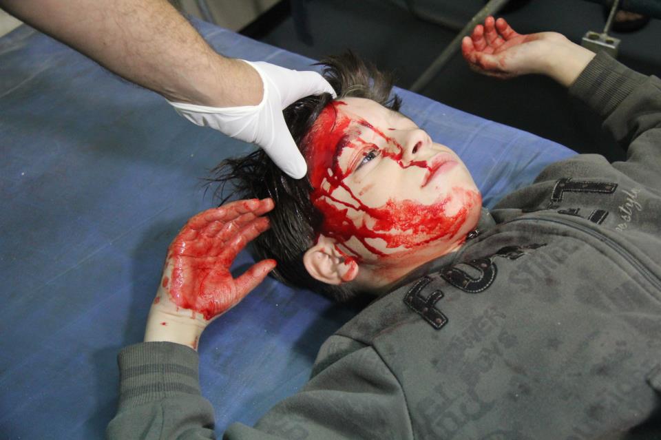 Photo Report: Gaza’s Epic: Children’s Blood, Will Conquer Pain