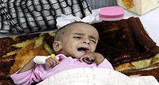 Yemen’s War through a Child’s Eyes: ’I Saw My Mum Burning in Front of Me’

