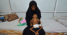 The Guardian: Yemen Famine Feared as Starving Children Fight for Lives in Hospital