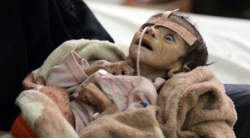 Saudi Arabia Devastating Yemen into Famine, US Refuses to Comment