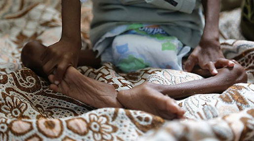 The US Provided Cover for the Saudi Starvation Strategy in Yemen
