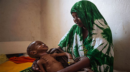 UN Warns: 1.4M Somali Children to Suffer Acute Malnutrition In 2017
