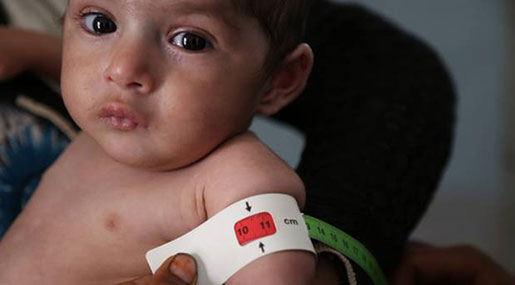 Yemen Is Broke, And Broken