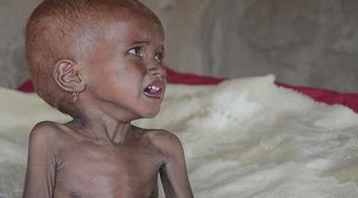 The UK Hypocritically Condemns Blockades in Syria but Not In Yemen