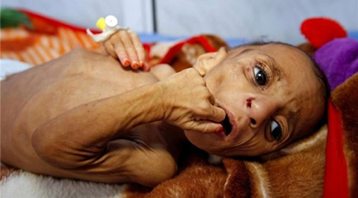 Don’t Be Fooled by Saudi «Aid» Efforts in Yemen