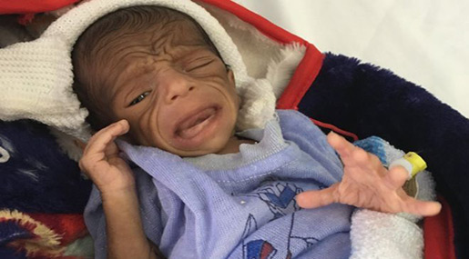 Baby Ibrahim 