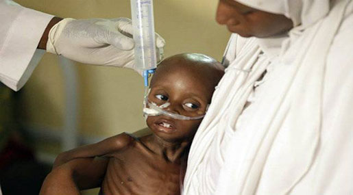 UNICEF Warns: 400,000 Children at Risk of Starvation in Nigeria UNICEF Warns: 400,000 Children at Risk of Starvation in Nigeria