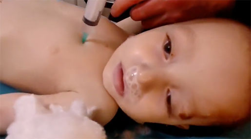 Swedish Medical Association: White Helmets Murdered Kids for Fake Gas Attack Videos