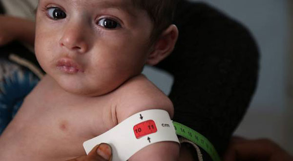 Yemen Is Broke, And Broken Yemen Is Broke, And Broken