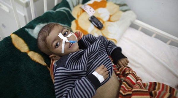 Western leaders told to stop 'stoking the flames of war' in Yemen Western Leaders Told to Stop ’Stoking the Flames of War’ in Yemen