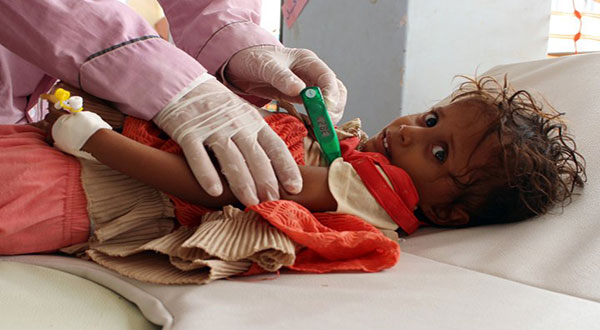 Cholera Is Slaughtering Yemen and We're Letting It Happen Cholera Is Slaughtering Yemen and We’re Letting It Happen