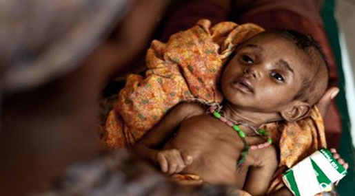 1/3 Children Malnourished in Drought-Hit Kenya 1/3 Children Malnourished in Drought-Hit Kenya