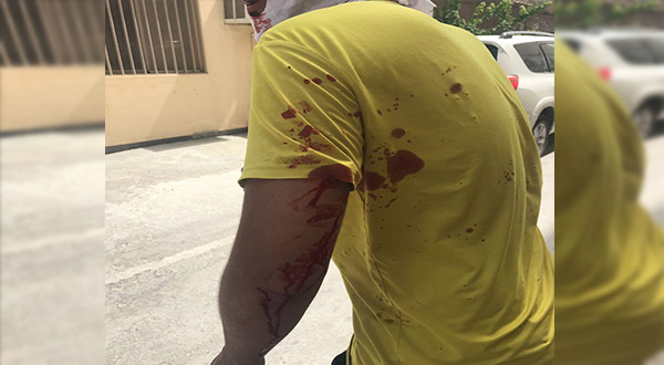 Bahraini Forces Storm Diraz, First Martyr Falls