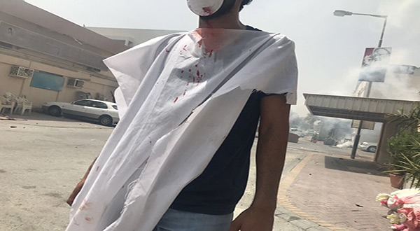 Bahraini Forces Storm Diraz, First Martyr Falls