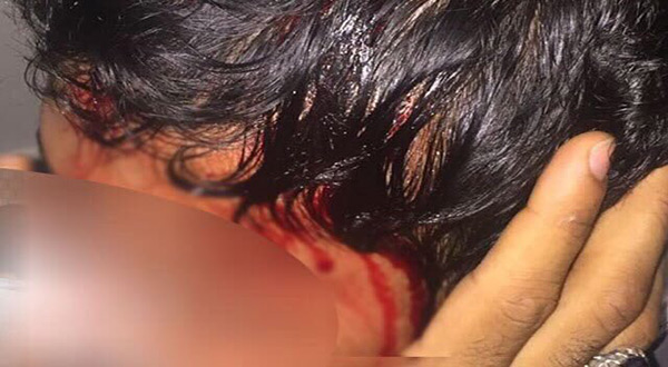 Bahraini Forces Storm Diraz, First Martyr Falls
