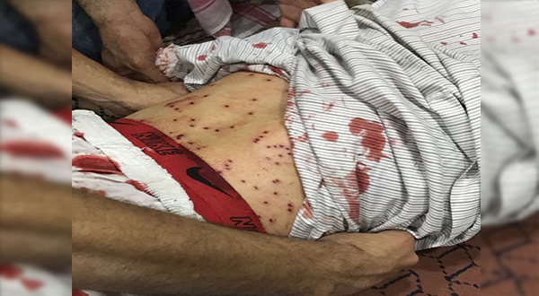 Bahraini Forces Storm Diraz, First Martyr Falls