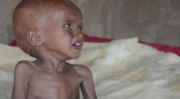 Yemen