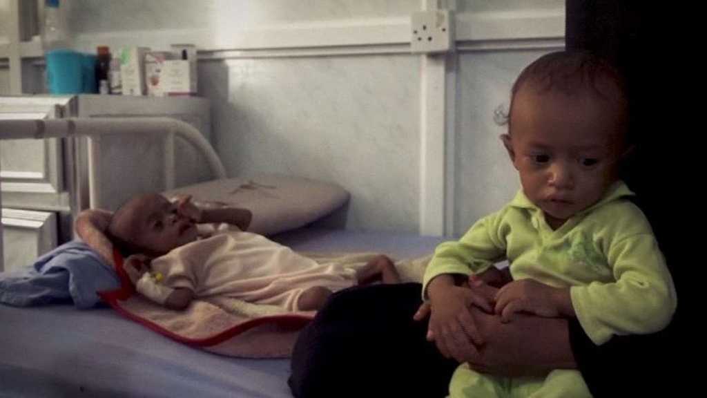 Scale of Yemen Famine Was ’Initially Underestimated’ By Aid Agencies