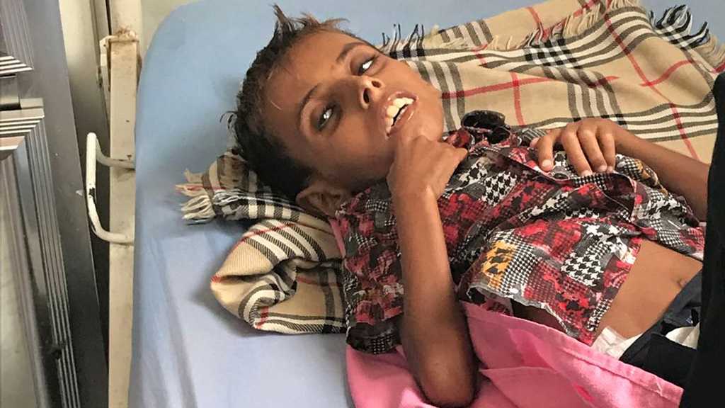 Yemen: The 10yo Boy Who Weighs Just 10kg in a Country on the Brink of Famine