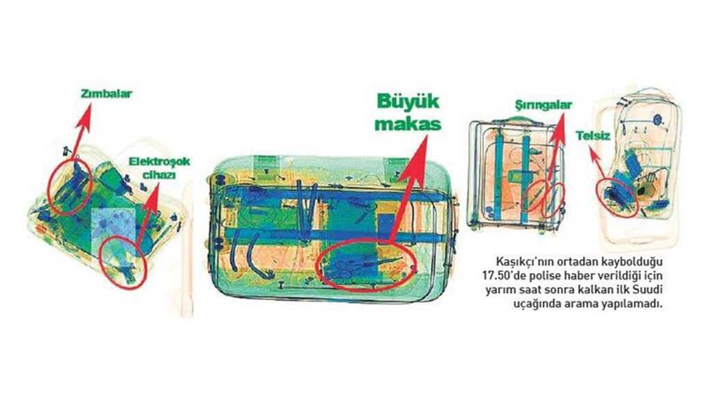 Khashoggi’s «Murder Kit» X-Ray PHOTOS Revealed by Turkish Media