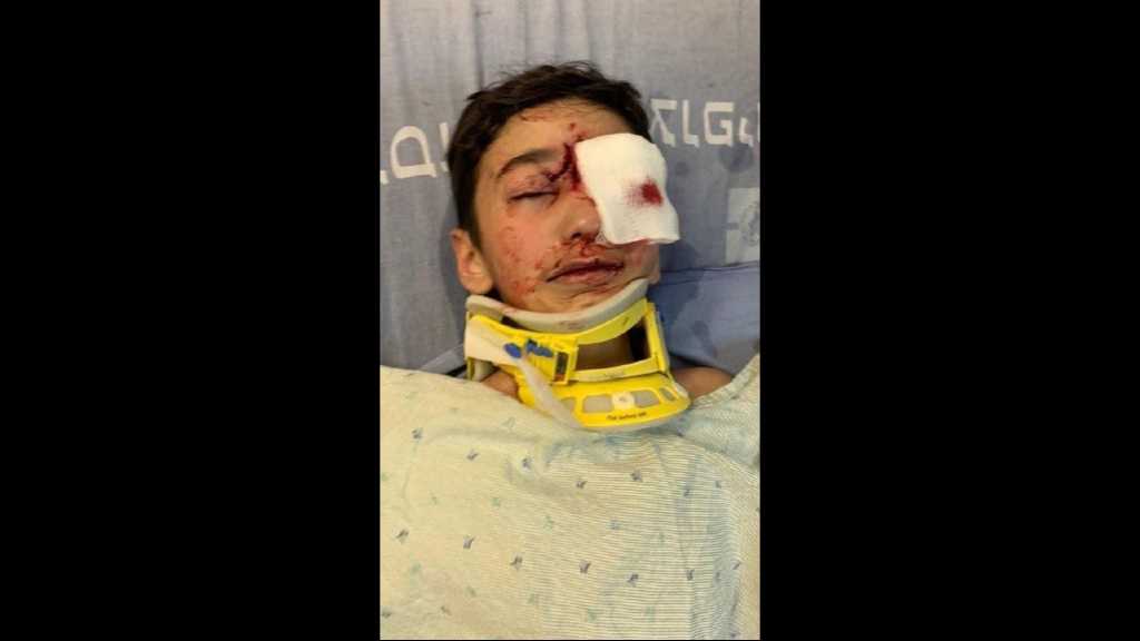 Palestinian Boy May Lose Eye after Being Shot by ‘Israeli’ Police