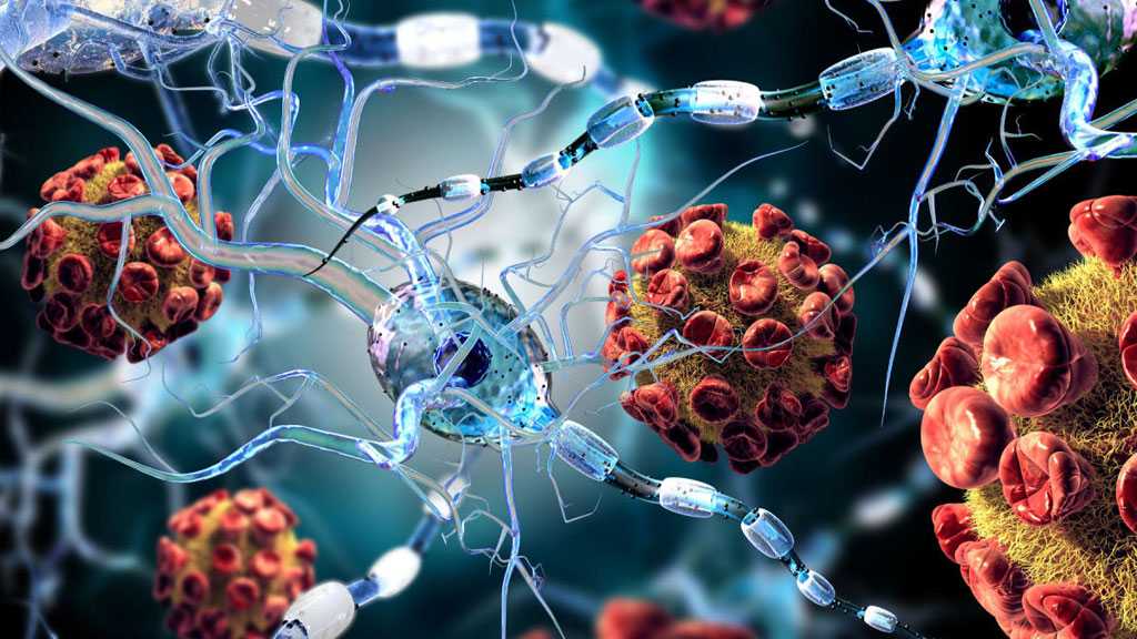 Preliminary Study Finds That Severe COVID-19 Can Damage the Brain