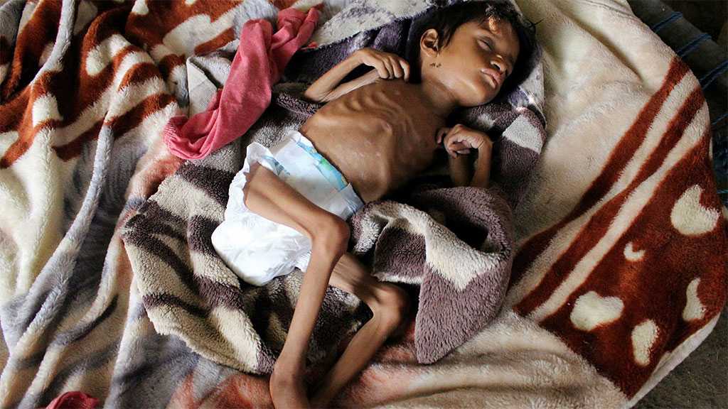 A Massive Famine Is Creeping Into Yemen, We Need To Stop It Devouring a Generation