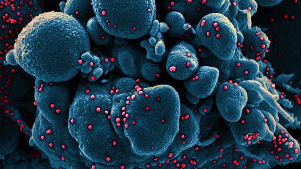 COVID-19 Causes Taste Loss Because Virus Infects Mouth’s Cells