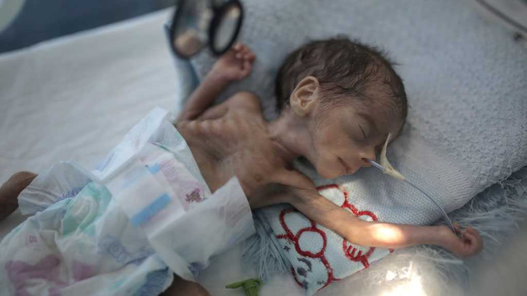 Yemen: Millions at Risk of Starvation as UN Is Short of Funds