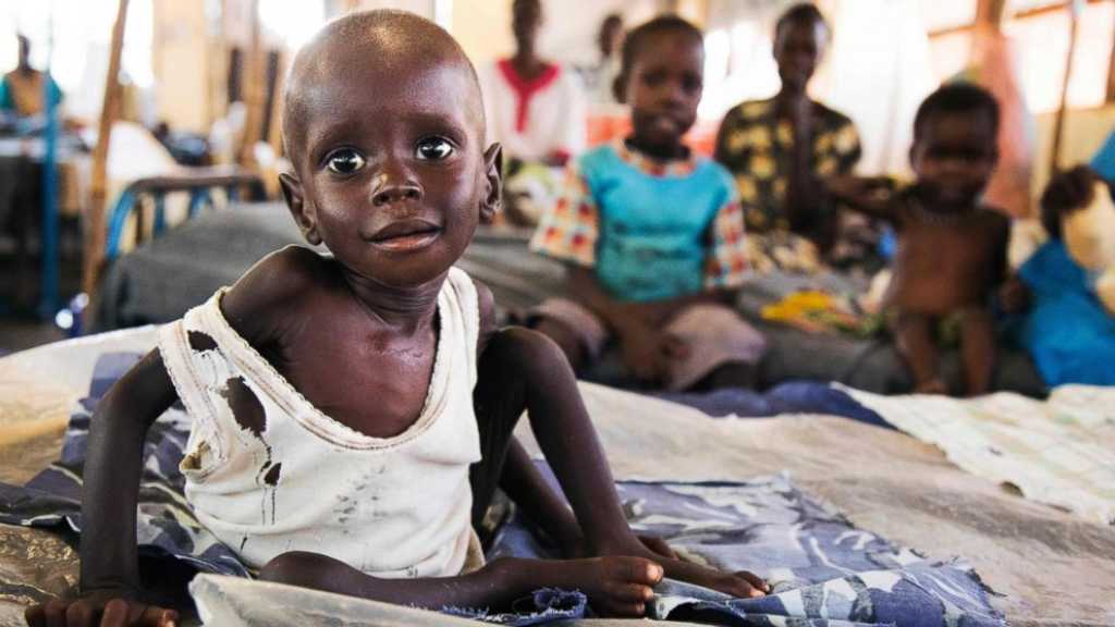 Sudan: Almost 500 Children Died from Hunger