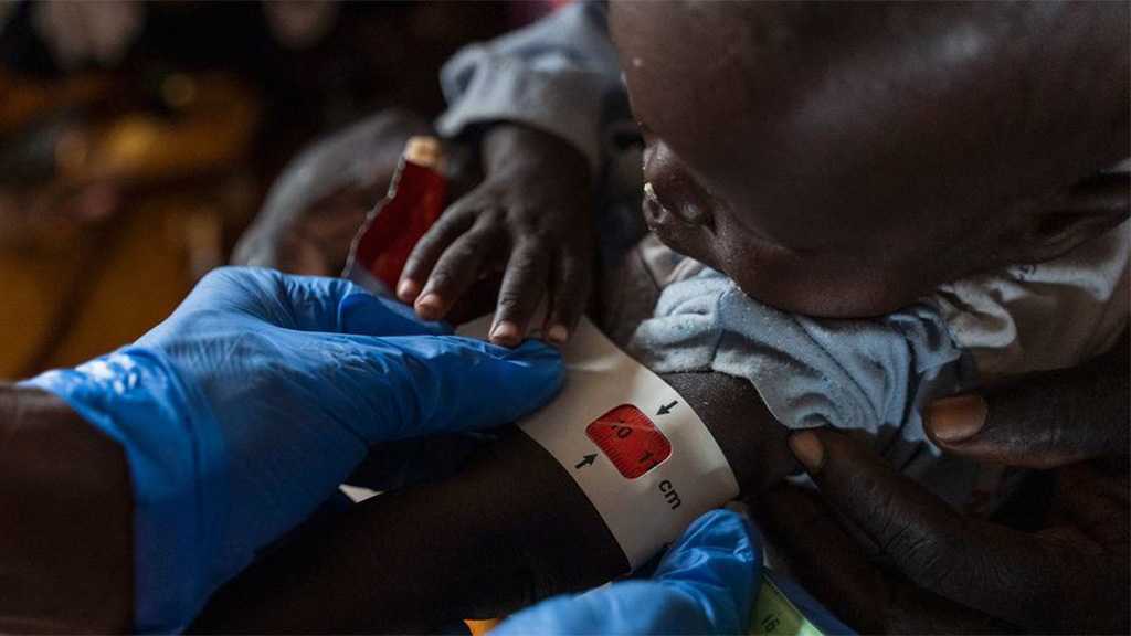 Sudan Children Dying Amid Healthcare System Collapse