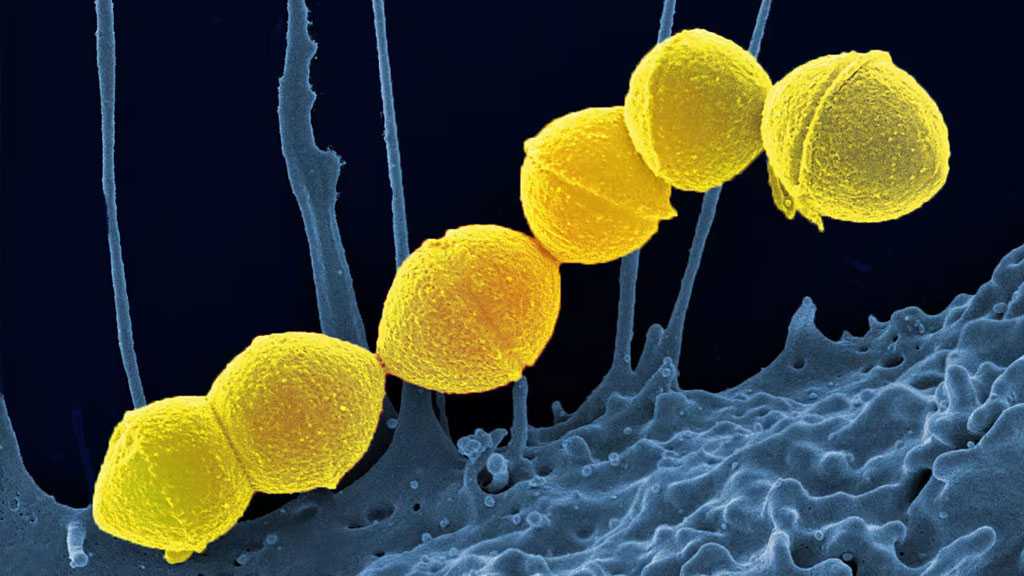 Mysterious, Dangerous Bacterial Infections Spreading in Japan