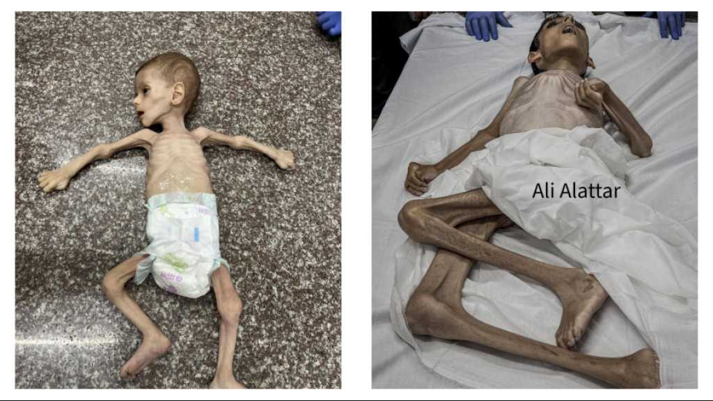 “Israeli” War of Starvation Martyrs Two More Palestinian Children in Gaza