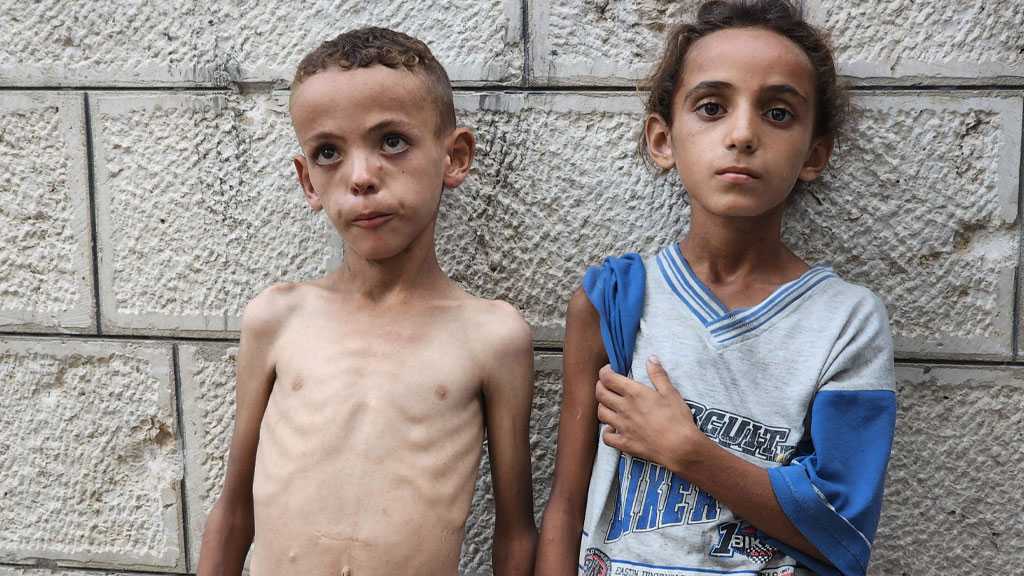 ‘We Faced Hunger Before, But Never Like This’: Skeletal Children Fill Hospital Wards As Starvation Grips Gaza