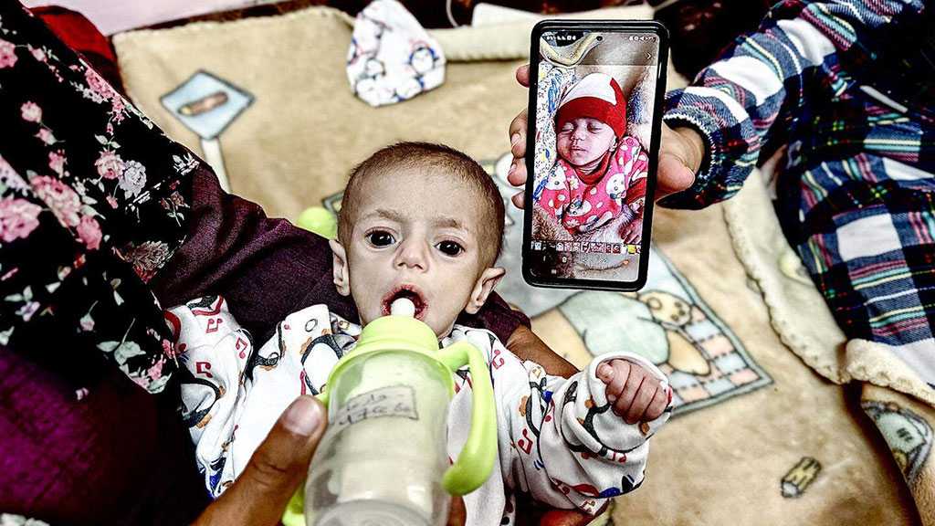 Gaza Health Ministry Warns of Guillain-Barré Syndrome Outbreak, Humanitarian Catastrophe