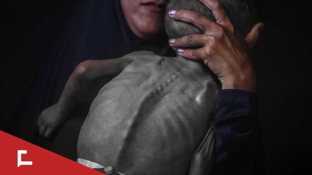 Gaza Records Highest-Ever Number of Children with Acute Malnutrition