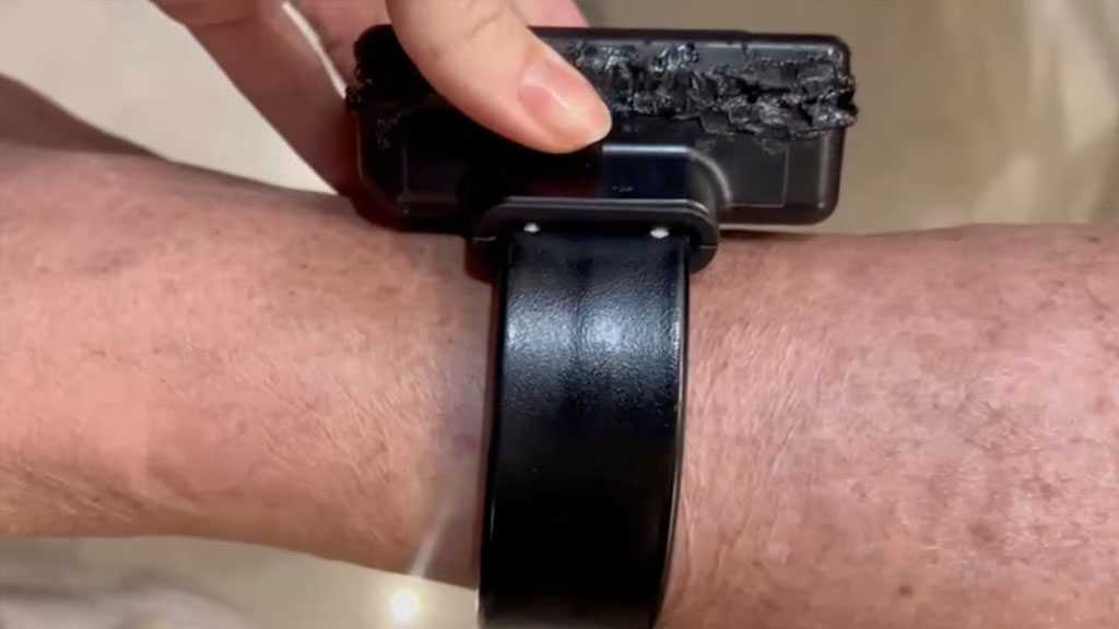 Bolsonaro Blames Drug “Hallucinations” for Ankle Monitor Tampering