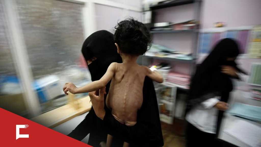 Yemen’s Growing Cancer Crisis After Years of Saudi War and Blockade